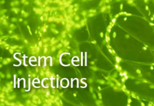 Stem Cell Injections