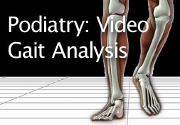Podiatry: Video Gait Analysis