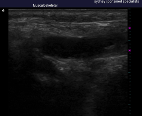 Musculoskeletal Ultrasound