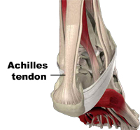 Achilles Tendon